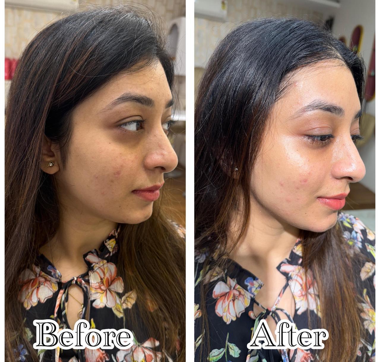 Skin glow profile — before and after