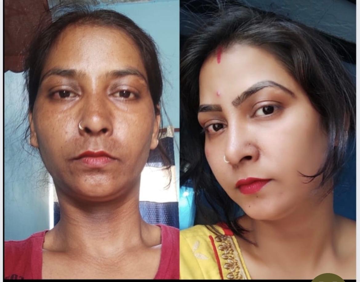 Anti-aging facial — before and after