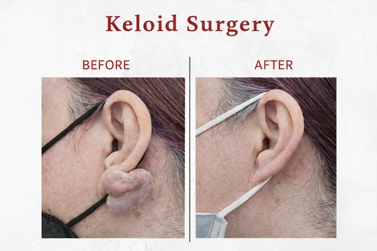 Hair growth therapy — before and after